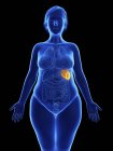 Frontal illustration of blue silhouette of obese woman with highlighted spleen on black background. — Stock Photo
