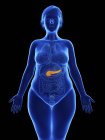 Frontal illustration of blue silhouette of obese woman with highlighted pancreas on black background. — Stock Photo