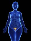 Frontal illustration of blue silhouette of obese woman with highlighted uterus on black background. — Stock Photo