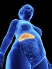 Basso angolo di visualizzazione illustrazione di silhouette blu di donna obesa con fegato evidenziato su sfondo nero . — Foto stock