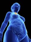 Low angle view illustration on black of silhouette of obese woman with highlighted thyroid gland. — Stock Photo