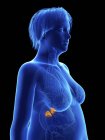 Illustration on black of silhouette of obese woman with highlighted adrenal glands. — Stock Photo