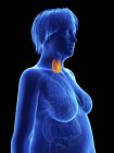 Illustration on black of silhouette of obese woman with highlighted thyroid gland. — Stock Photo