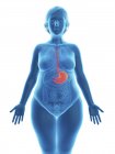 Illustration of blue silhouette of obese woman with highlighted stomach. — Stock Photo