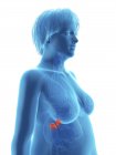 Ілюстрація синій силует ожирінням жінка з виділених надниркових залоз. — стокове фото