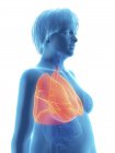 Ilustração da silhueta azul da mulher obesa com pulmões destacados . — Fotografia de Stock