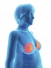 Ілюстрація синій силует ожирінням жінка з виділених молочних залоз. — стокове фото