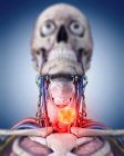 Ілюстрація пухлини щитовидної залози в реалістичному скелеті . — стокове фото