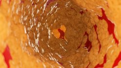 Ilustración de grasa dentro de la arteria humana
. - foto de stock