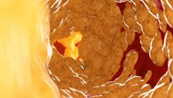 Иллюстрация жира внутри человеческой артерии . — стоковое фото