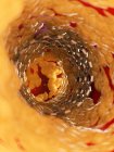 Иллюстрация стента внутри человеческой артерии . — стоковое фото