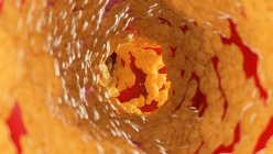 Медицинская иллюстрация жира внутри человеческой артерии . — стоковое фото