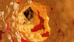 Illustration médicale de graisse à l'intérieur de l'artère humaine
. — Photo de stock