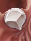 Medical illustration of artificial heart valve. — Stock Photo