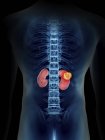 Mid section illustration of transparent blue silhouette of male body with colored kidney tumour. — Stock Photo