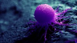 Ilustración digital a color de la célula cancerosa púrpura . - foto de stock
