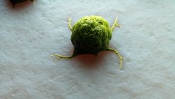 Digital artwork of green cancer cell on tissue surface. — Stock Photo