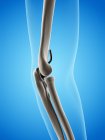 Illustration of elbow replacement prosthesis on blue background. — Stock Photo