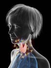 Ilustración de silueta de mujer mayor mostrando glándula tiroides atacada por anticuerpos . - foto de stock