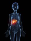 Illustration of senior woman with liver tumour on black background. — Stock Photo
