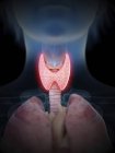 Illustration de la silhouette humaine avec inflammation de la glande thyroïde . — Photo de stock