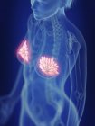 Ilustración de glándulas mamarias inflamadas en el cuerpo humano . - foto de stock