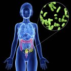 Illustration of female silhouette with highlighted colon infection. — Stock Photo