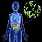 Illustration of female silhouette with highlighted intestine infection. — Stock Photo