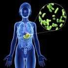 Illustration of female silhouette with highlighted stomach infection. — Stock Photo