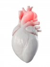 Ілюстрація аневризма аорти в людському серці. — стокове фото