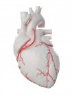 Illustration of bypass in human heart. — Stock Photo