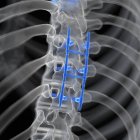 Illustration of spinal fusion in human skeleton. — Stock Photo