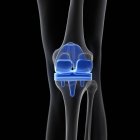 Ilustración médica del reemplazo de rodilla sobre fondo negro . - foto de stock