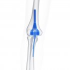 Illustration de prothèse de remplacement bleu coude sur fond blanc . — Photo de stock