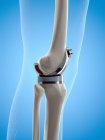Иллюстрация имплантата для замены колена на синем фоне . — стоковое фото