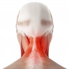 Illustrazione del collo umano doloroso su sfondo bianco
. — Foto stock