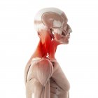 Иллюстрация болевых мышц шеи на белом фоне
. — стоковое фото