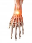 Illustration des schmerzhaften Handgelenks des menschlichen Skeletts. — Stockfoto