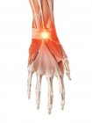 Illustration du poignet douloureux du squelette humain . — Photo de stock