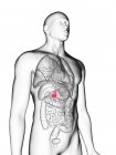 Ilustración de silueta gris transparente del cuerpo masculino con vesícula biliar de color . - foto de stock