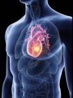 Illustrazione della silhouette blu trasparente del corpo maschile con tumore al cuore colorato
. — Foto stock