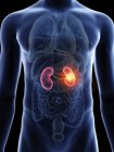 Illustrazione a metà sezione del cancro ai reni nella silhouette del corpo maschile . — Foto stock
