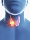Illustration du cancer de la glande thyroïde dans la silhouette du corps masculin, gros plan . — Photo de stock