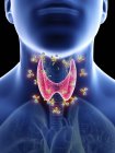 Illustrazione della malattia tiroidea autoimmune nella silhouette della gola umana . — Foto stock
