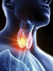 Ilustración de cerca del cáncer de glándula tiroides en la silueta corporal masculina . - foto de stock