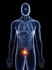Ілюстрація рак сечового міхура в чоловічому організмі силует на чорному фоні. — стокове фото