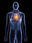Ilustración de tumor cardíaco en silueta corporal masculina sobre fondo negro . - foto de stock
