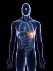 Ілюстрація раку селезінки в силуеті чоловічого тіла на чорному тлі . — стокове фото