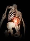 Illustration du squelette humain colonne vertébrale douloureuse . — Photo de stock