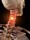 Illustration des schmerzhaften Halses des menschlichen Skeletts. — Stockfoto